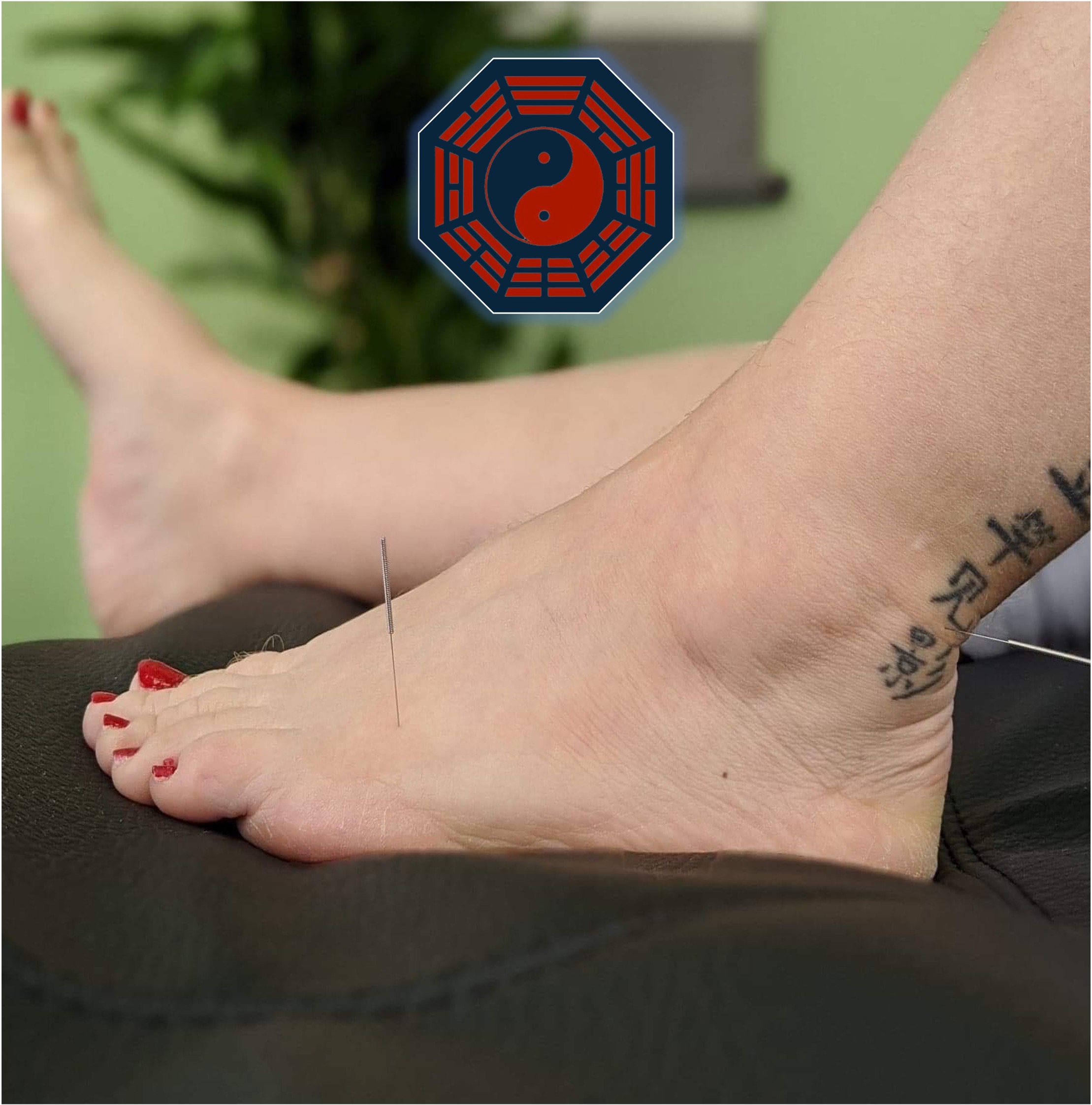 vStore Category Image Access Acupuncture insta size